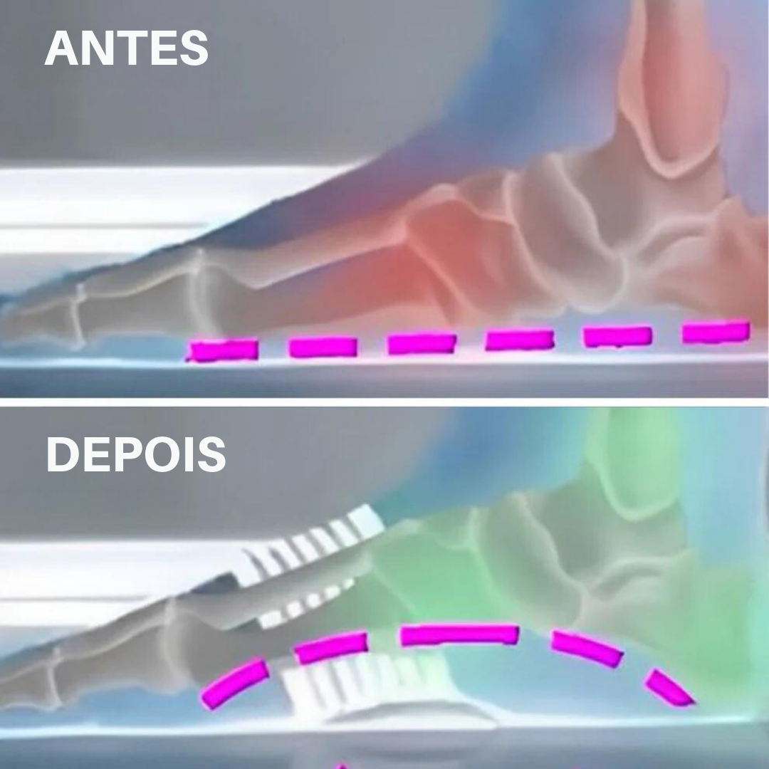 Fita ortopédica para pés - OrtoPies
