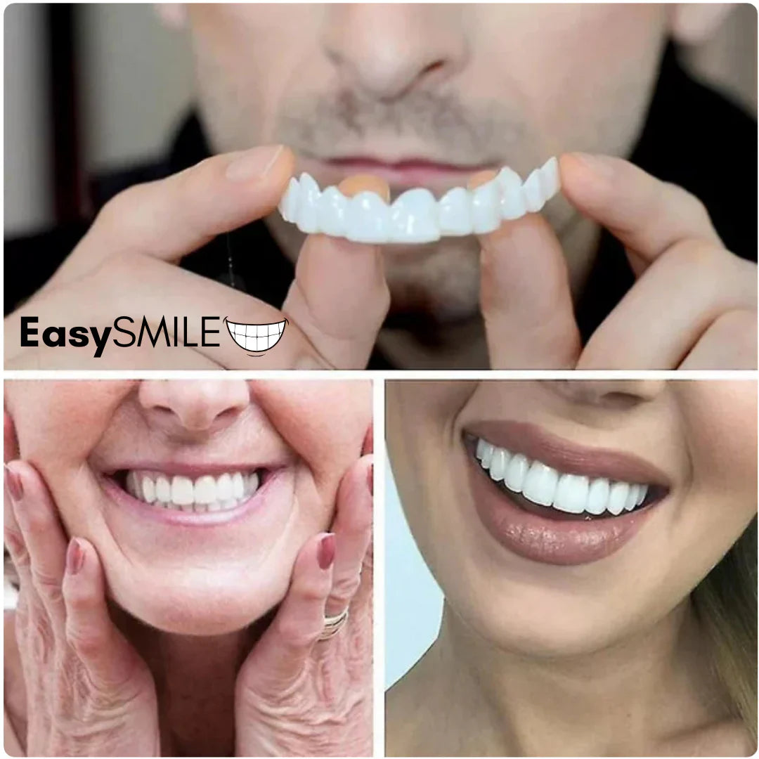 EasySmile | Facetas dentárias de cerâmica personalizadas (conjunto superior e inferior)