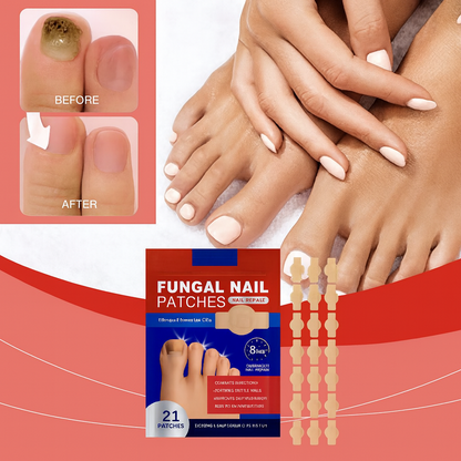 Adesivo antifúngico para unhas - Nail Shield™