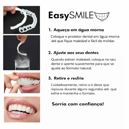 EasySmile | Facetas dentárias de cerâmica personalizadas (conjunto superior e inferior)