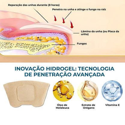 Adesivo antifúngico para unhas - Nail Shield™